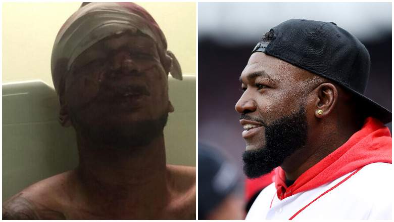 La Policía identifica como Eddy Feliz a hombre baleó a David Ortiz en bar SDE