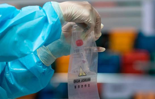 En seis meses el COVID-19 ha matado 1,738 personas y contagiado a 94,979